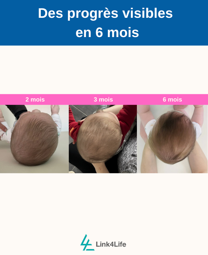 Programme Expert Plagiocéphalie : 10 ans d'expérience pour vous accompagner