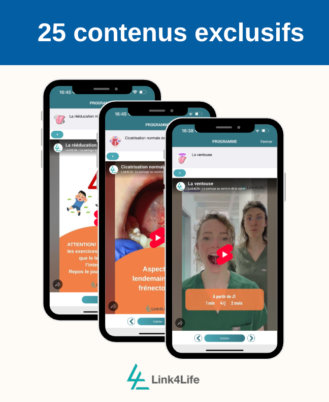 Frénectomie linguale : post-op enfant/adulte avec Sereniteeth