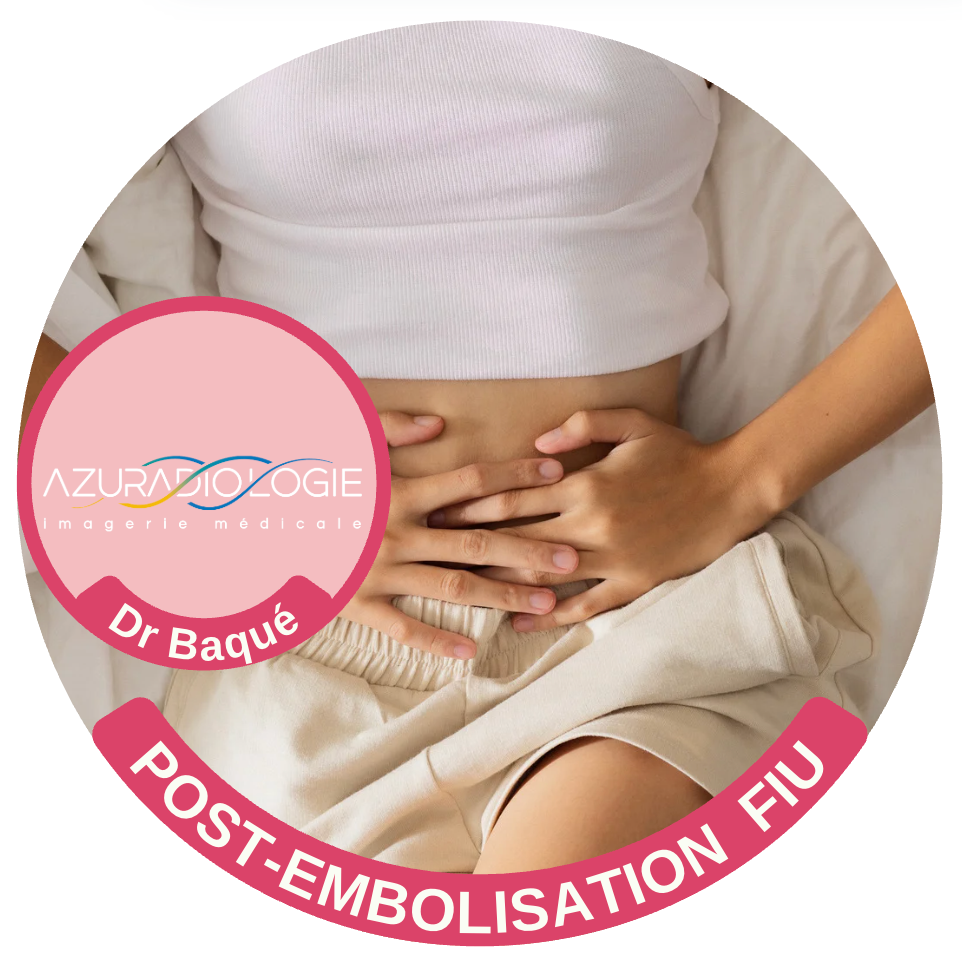 Programme Post-Embolisation FIU