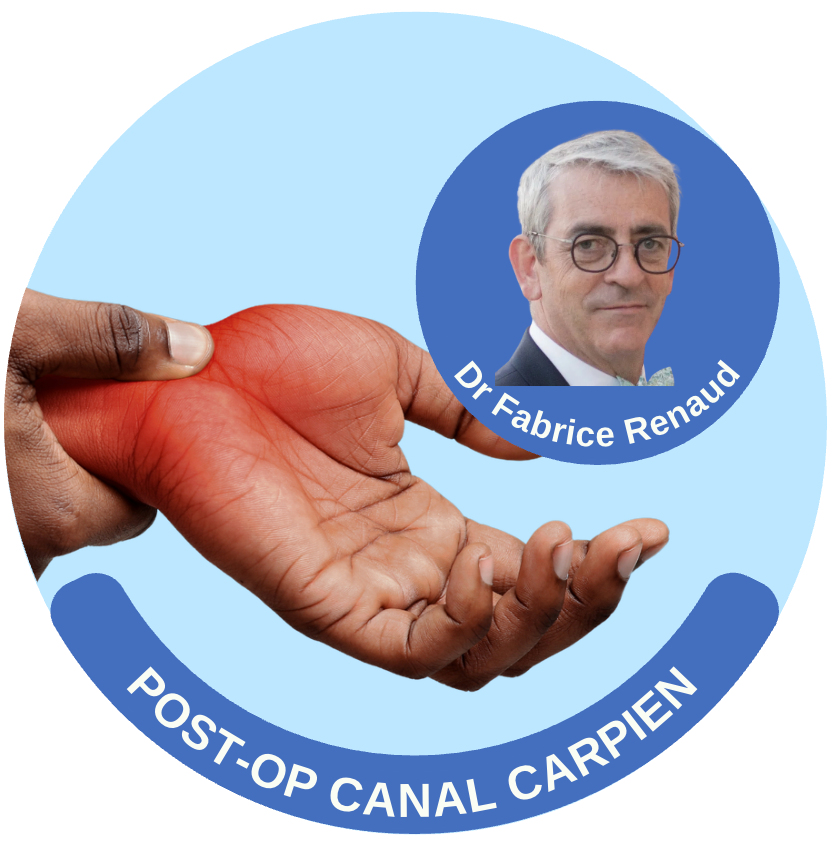 Programme Post-op canal carpien du Dr Fabrice Renaud
